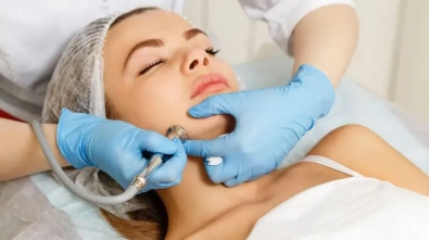 Microdermabrasion (2)