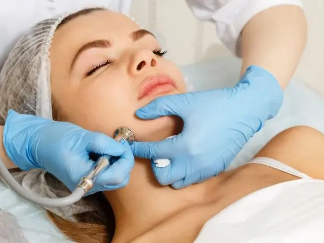 Microdermabrasion (2)