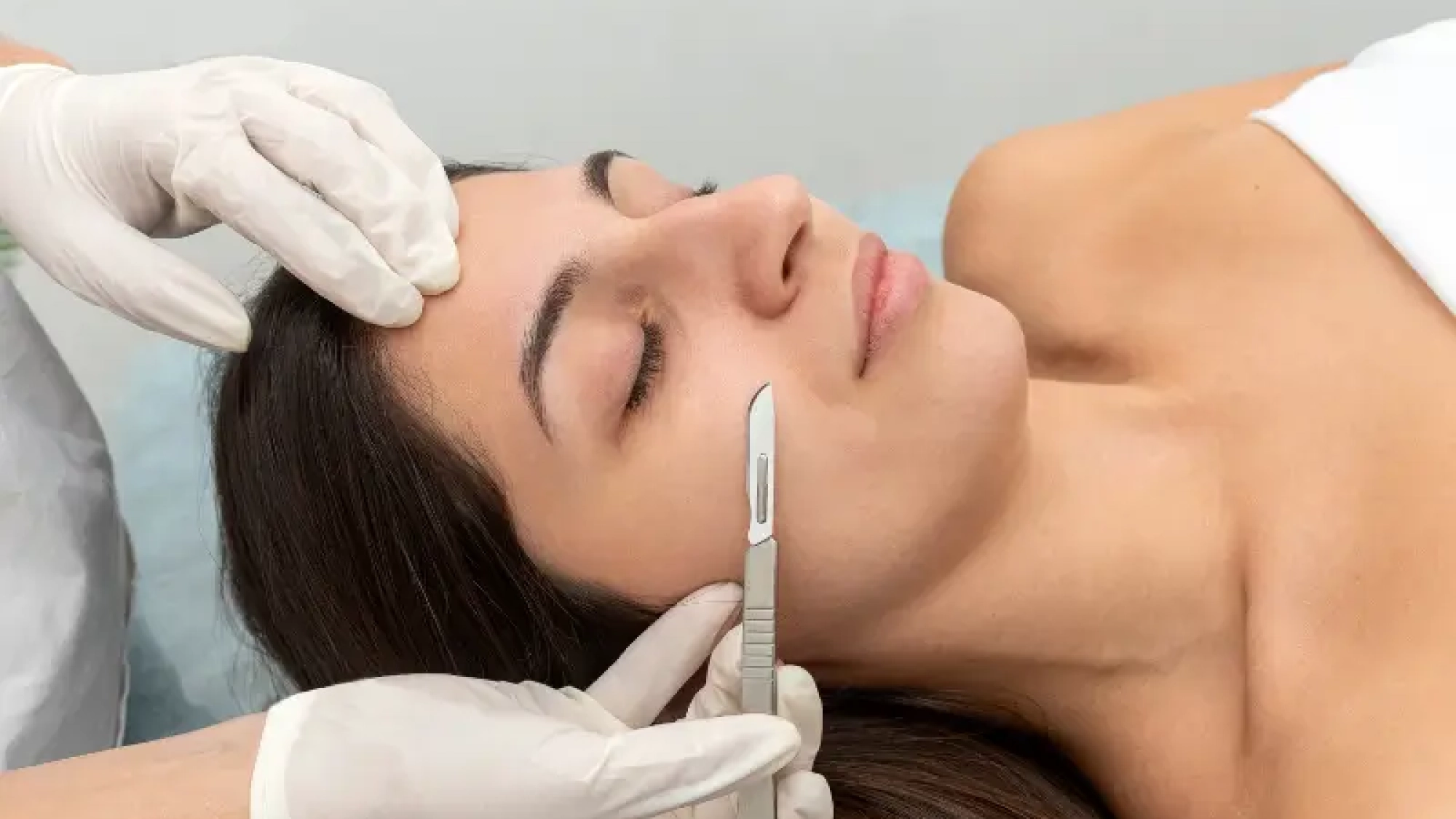 dermaplaning