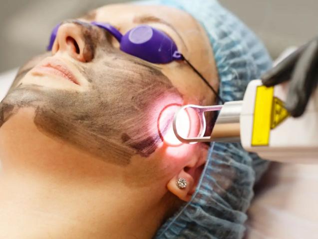 laser dark spot removal