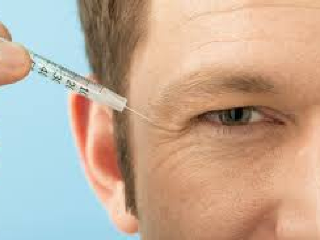 The Cost of Botox | What You Need to Know