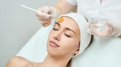 Chemical Peels