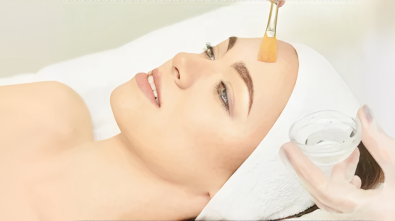 VI Facial Peel