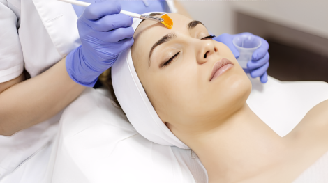 Chemical Peel