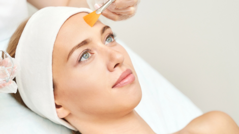 Best Chemical Peel
