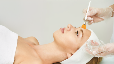 Chemical Peel Greeley