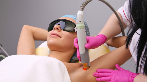 Laser Hair Removal in Greeley