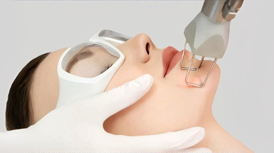 CO₂ Fractional Laser