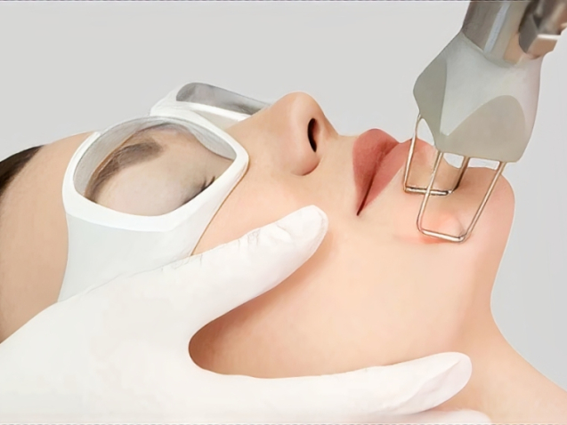 CO₂ Fractional Laser